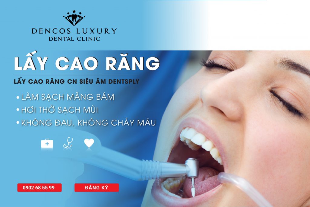 Lấy cao răng bao nhiêu tiền? Chi phí cập nhật mới nhất 2020