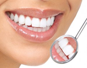Bọc răng sứ có ảnh hưởng không? Bí quyết khỏe và đẹp
