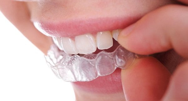 cách chữa nghiến răng ở người lớn 6
