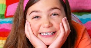Niềng răng cho trẻ em giá bao nhiêu? – Chi phí cụ thể