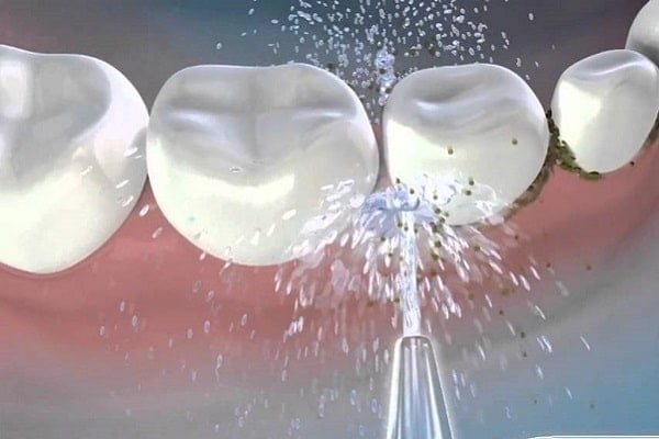 cách lấy cao răng bằng giấm 7