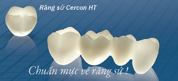 Răng sứ Cercon HT