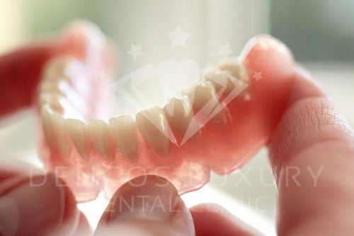 răng sứ titan là gì