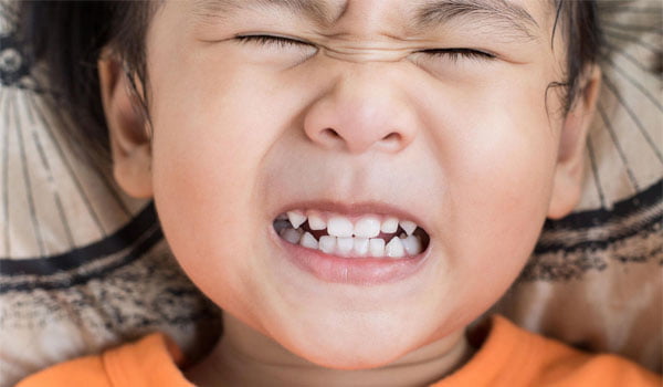 Nghiến răng ở trẻ em