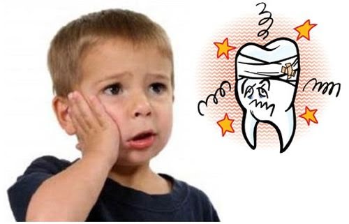 Viêm tủy răng ở trẻ em