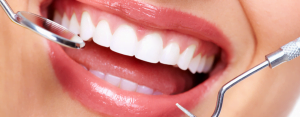 Đọc ngay để biết lấy cao răng có ảnh hưởng gì không?