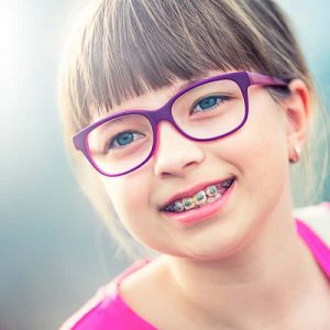 Niềng răng cho trẻ em ở đâu tốt? – Nỗi lo của của các bậc phụ huynh