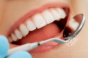 Lạm dụng thẩm mỹ: Hậu quả của bọc răng sứ không đúng phương pháp