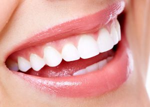 Bọc răng sứ có bền không? [Kiến thức nha khoa]