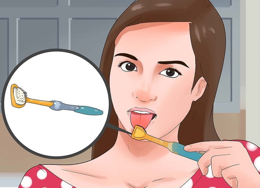 cách trị bệnh hôi miệng bằng việc làm sạch lưỡi