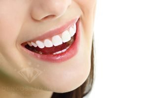 Bật mí chăm sóc răng sứ đúng cách giúp duy trì thời gian dài lâu