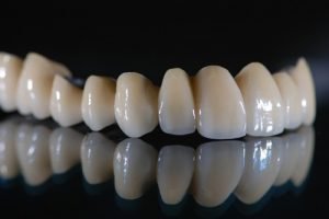 Cách chăm sóc răng sứ titan đúng cách cho tuổi thọ dài lâu