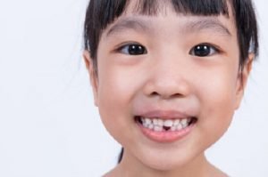 Nhổ răng sữa cho bé và những lưu ý quan trọng mà cha mẹ nên biết