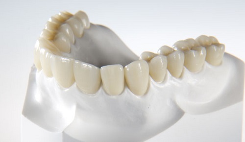  Răng sứ có hình dáng và màu sắc tương tự với răng thực 