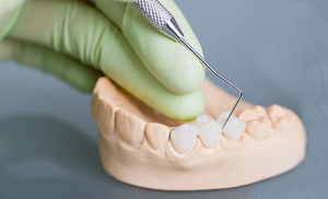 Cách chăm sóc răng sứ cho hàm răng trắng đẹp tự nhiên