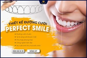 Thiết kế đường cười Perfect Smile: Nụ cười xinh thu hút mọi ánh nhìn