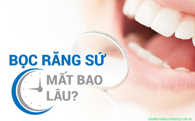 Bọc răng sứ mất bao lâu?