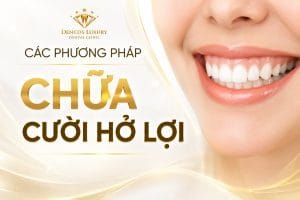 Chữa cười hở lợi: Hạn chế đau, không để lại sẹo và cho kết quả cao