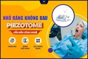 Nhổ răng không đau công nghệ siêu âm Piezotome hiện đại nhất 2021