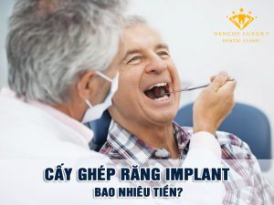 Cấy ghép răng implant giá bao nhiêu? – Bảng giá dịch vụ mới nhất