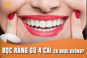 Bọc răng sứ 4 cái có được không hay phải bọc toàn hàm? – BS tư vấn