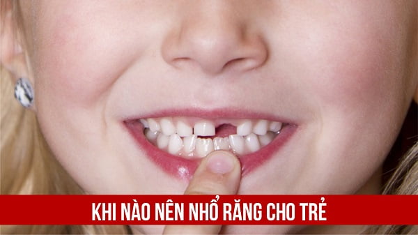 nhổ răng cho trẻ 3 tuổi