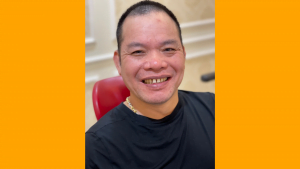 Khách hàng Dương Văn Ba lựa chọn về Việt Nam cải thiện nụ cười của mình