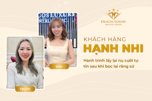 BỌC LẠI RĂNG SỨ: Hành trình lấy lại nụ cười tự tin của khách hàng